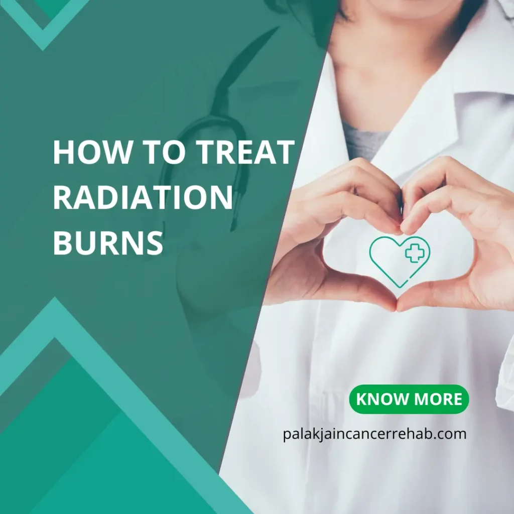 How to Treat Radiation Burns