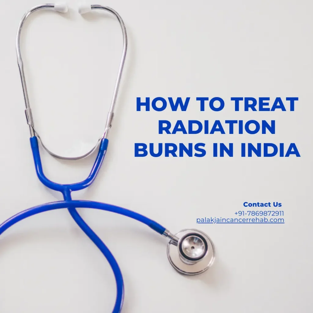 How to Treat Radiation Burns in India